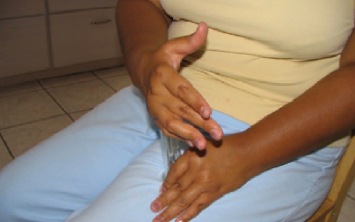 A patient with severe arthritis demonstrating how she would use a prototype injector with stiff fingers